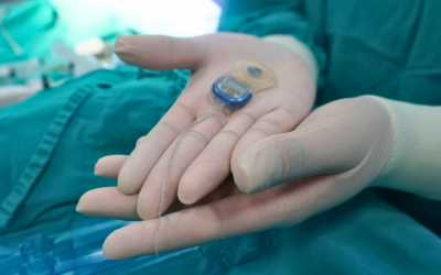 Se realiza la primera cirugía de implante coclear en Clínica San Gabriel a niña con hipoacusia bilateral