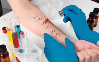 Alergia e Inmunología