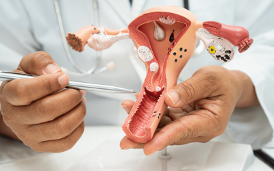 Ginecología Oncológica