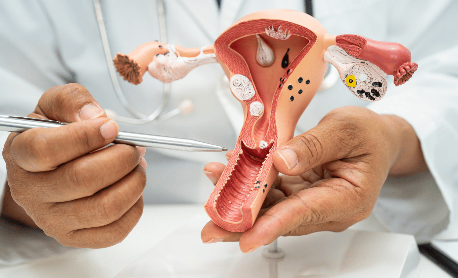 ginecología oncológica